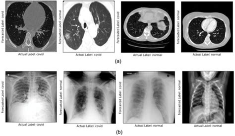 Novel Comparative Study for the Detection of COVID-19 Using CT Scan and ...