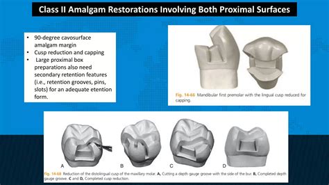 Retention and resistance forms of cavity design | PPTX
