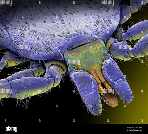 American dog tick (Dermacentor variabilis), coloured scanning electron micrograph (SEM). This ...