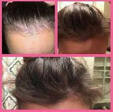 Baby Hair Fall Out Grow Back by Pin By Holzer On Monat Modern Nature Monat Hair Baby Hair Fall Out Grow Back