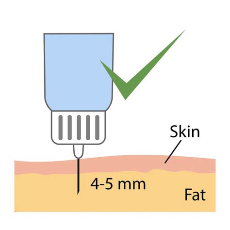 Angle of Injection 的图像结果