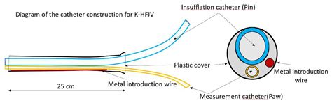 Catheter High-Frequency Jet Ventilation and Its Basic Technical and ...