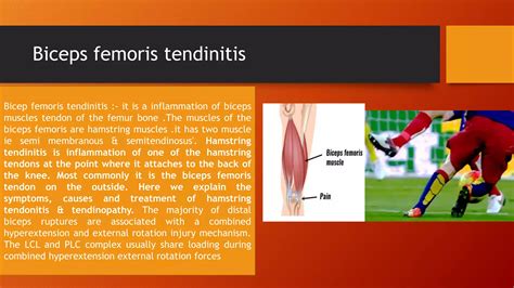 Bicep Femoris Tendinitis | PDF
