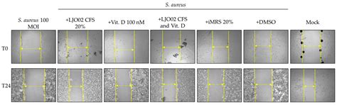 Lactobacillus johnsonii LJO02 (DSM 33828) Cell-Free Supernatant and ...