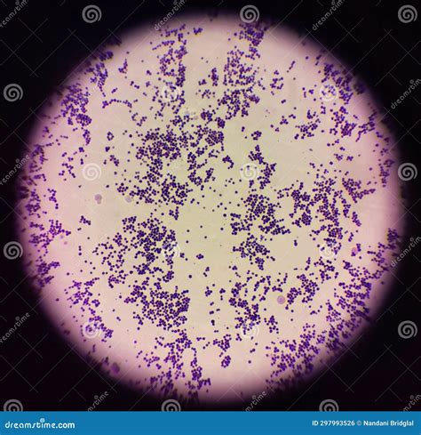 Gram Stain of Staphylococcus Aureus Stock Photo - Image of analysis ...