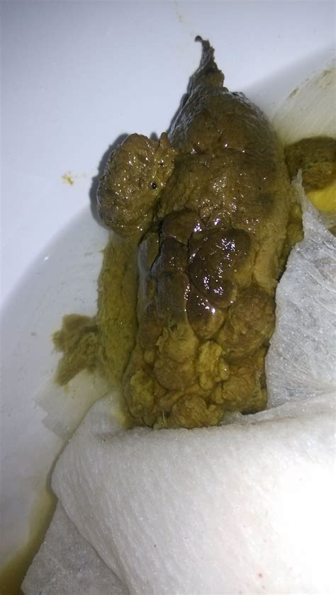 正常的大便颜色形状正常的大便颜色2022已更新今日动态