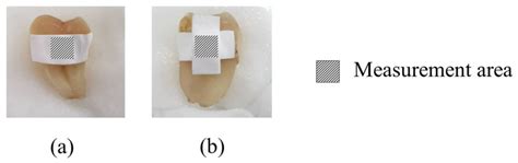 Enhancing Stability and Tooth Bleaching Activity of Carbamide Peroxide ...