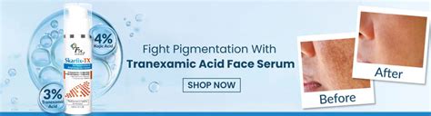 Buy Skin & Haircare Products Online in India - Fixderma Skincare