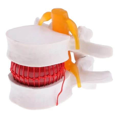 Disk Problem 的图像结果