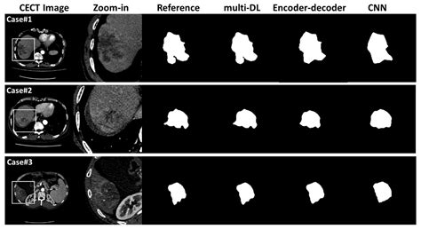 Multi-Task Deep Learning Approach for Simultaneous Objective Response ...