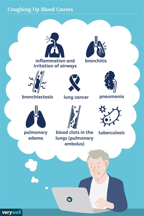 Wann ist Bluthusten ein Notfall? - MedDe