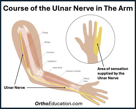 Ulnar Nerve Palsies - Elbow Education