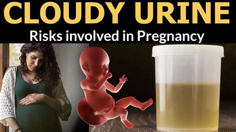 Cloudy Urine in Pregnancy || When to worry and When not to during ...