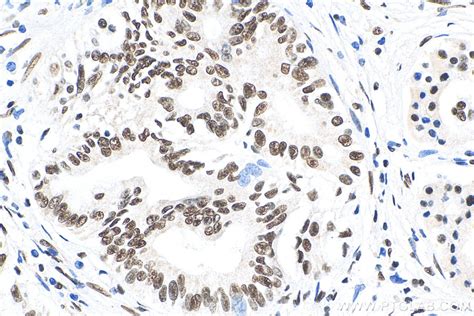 HMGA2 antibody (20795-1-AP) | Proteintech