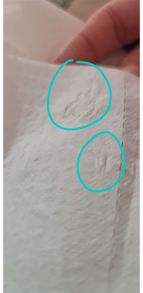 Nasal drainage : r/NasalPolyps