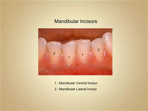 morphology of mandibular central and lateral incisors teeth | PPT