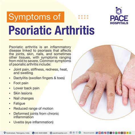Psoriatic Arthritis: Symptoms, Causes, Treatment & Prevention