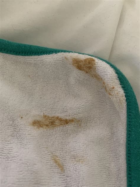 Baby Spit Up Brown Mucus at Kristen Mcdonald blog