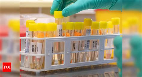 What is chloroquine and could it cure the coronavirus? - Times of India