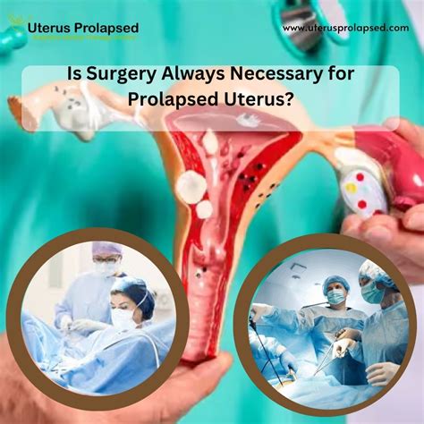 Stages Of Uterine Prolapse: How to Recognize the Severity?
