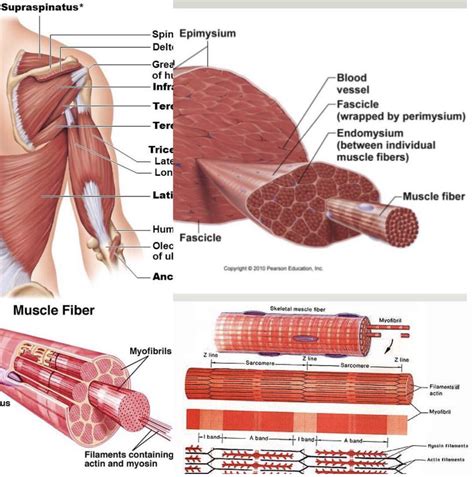 Delayed Onset Muscle Soreness Diagram