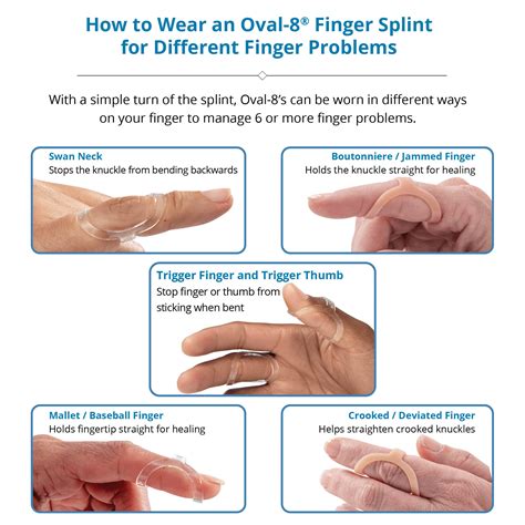 What Size Oval-8 Splint Do I Need? Ohmyarthritis.com Updated Oct 2023