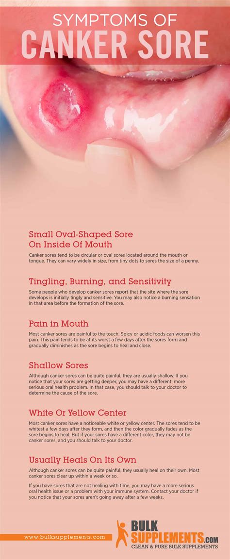 Canker Sores: Symptoms, Causes and Treatment