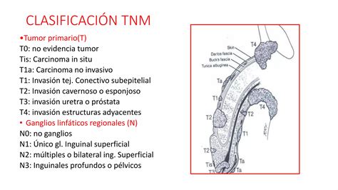 Cancer de pene | PPT