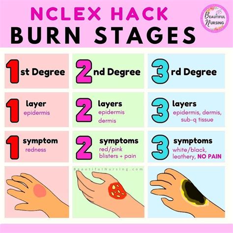 Nclex tip disseminated intravascular coagulation dic – Artofit