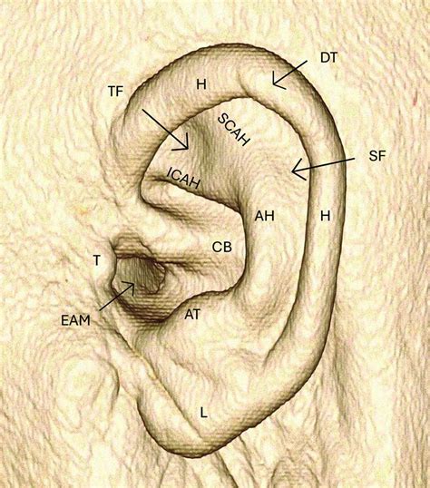 Anatomy Of Outer Ear Diagram Sensorineural Vs Conductive Hearing Loss