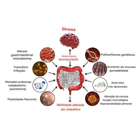 Síndrome do Intestino Irritável: Guia Completo Atualizado