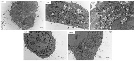 Synergistic Anticancer Effect of Glycolysis and Histone Deacetylases ...