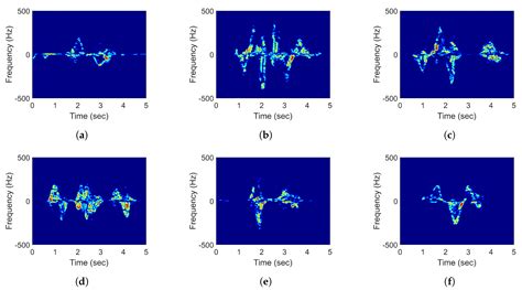 Arm Motion Classification Using Time-Series Analysis of the Spectrogram ...