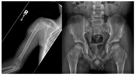 World-Renowned “Swiss” Pediatricians, Their Syndromes, and Matching ...