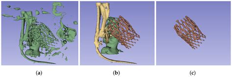 Automatic Assessment of Transcatheter Aortic Valve Implantation Results ...