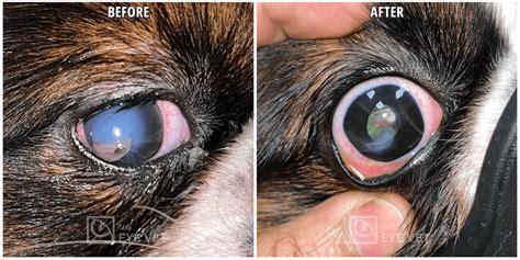 Corneal Ulcer Scar Confronting Corneal Ulcers American Academy Of