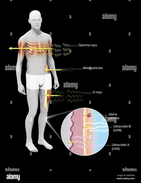Radiation effects on humans, illustration. Six types of radiation are shown impacting a human ...