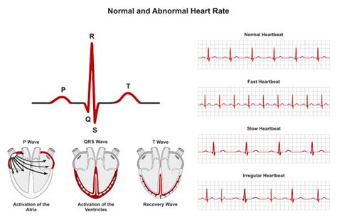 Diastolic Dysfunction Diagnosis & Treatments Marbella