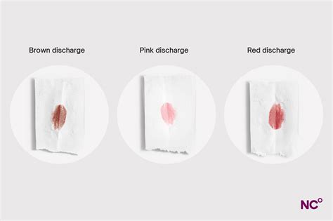 Brown Discharge: Causes & When To Be Concerned