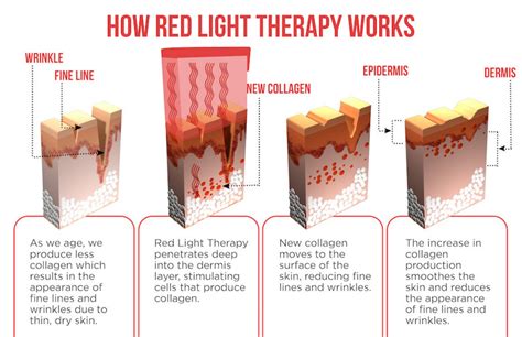 Does It Work Red Light Therapy