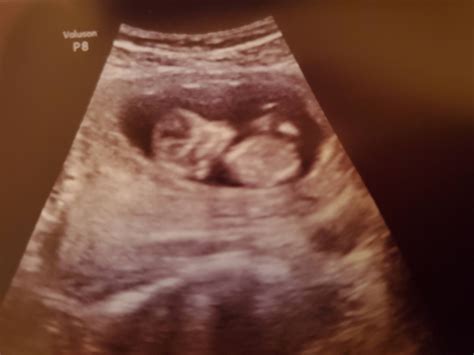 12 week ultrasound. I had no idea I would see it move so much! : predaddit