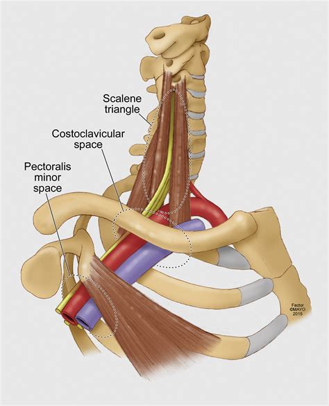 Reporting standards of the Society for Vascular Surgery for thoracic outlet syndrome - Journal ...