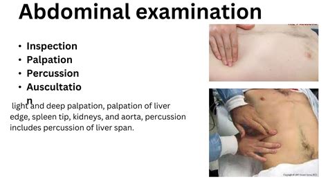 ABDOMINAL EXAMINATION Presentation[1].pptx