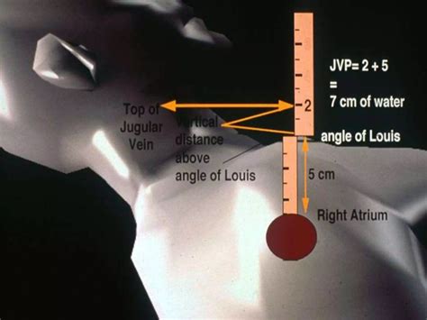 Jugular venous pressure | PPTX