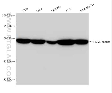 PKM2-specific antibody (84451-1-RR) | Proteintech