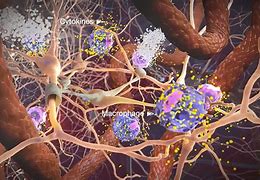 Image result for neurotoxicity
