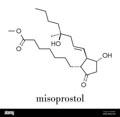 Cervix labor Stock Vector Images - Alamy