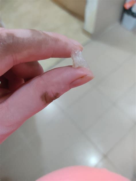 Mucus Plug Discharge Pieces