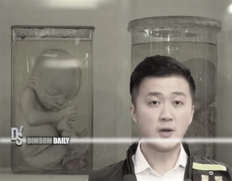 Suspected formalin solution used to preserve two 24-30-week-old infant ...