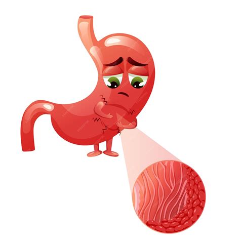 Personaje de dibujos animados triste de estómago con inflamación de gastritis en las células ...
